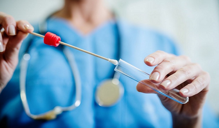 Covid-19, Comitato Tecnico-Scientifico: al momento efficace solo il tampone basato sull’identificazione dell’RNA virale