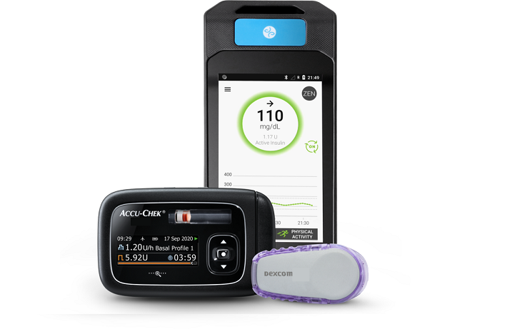 Diabete: nuovo sistema ibrido ad ansa chiusa per somministrazione automatica di insulina